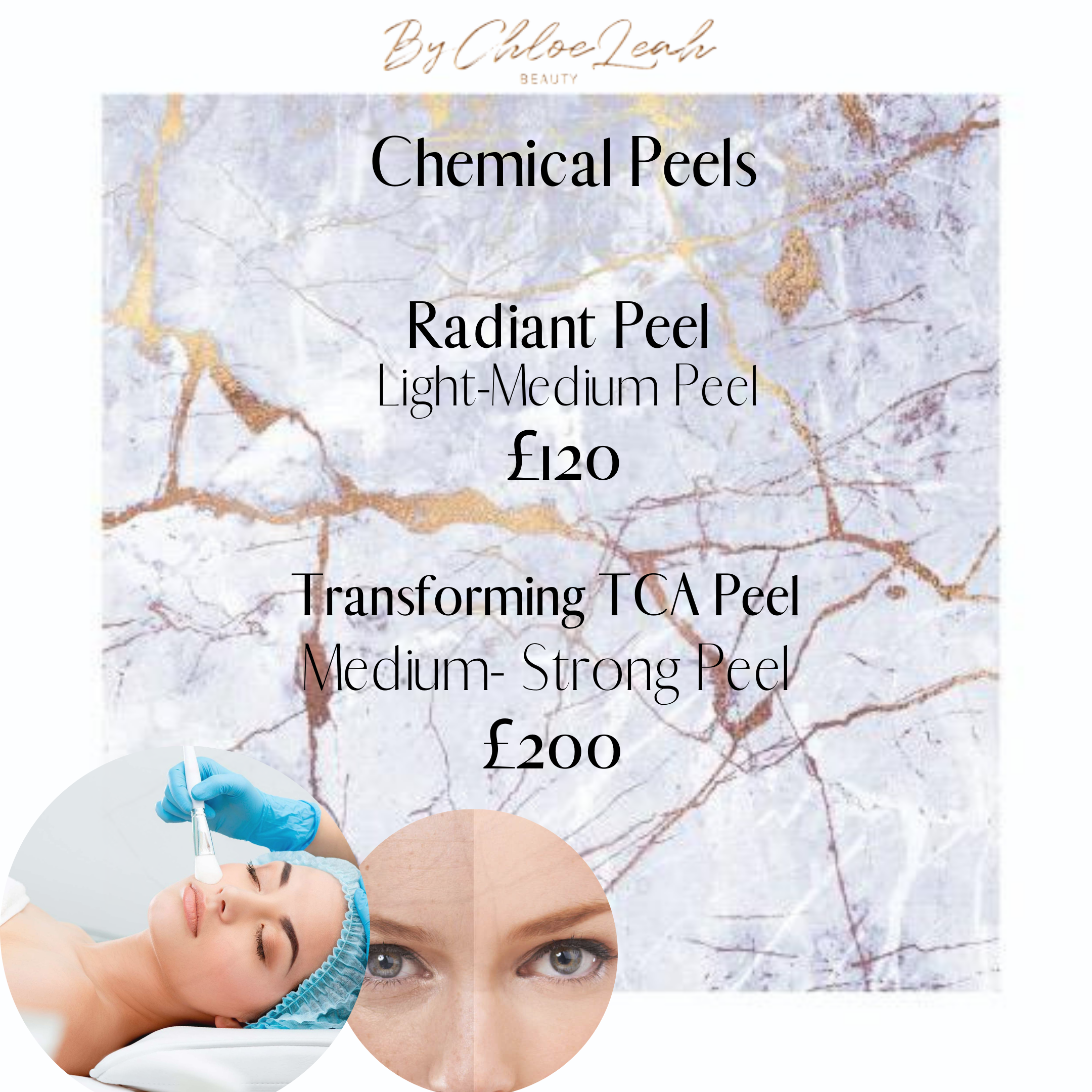 Rich results on Google's SERPS when searching for 'Chemical Skin Peels'